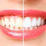 Healthy Smile