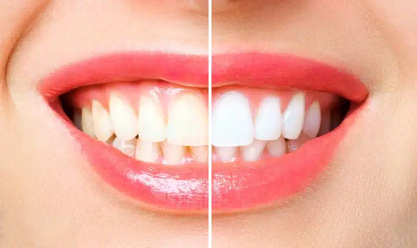 Healthy Smile